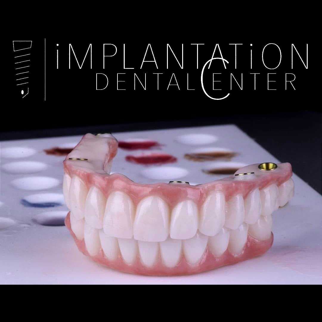 Implantation Dental Center